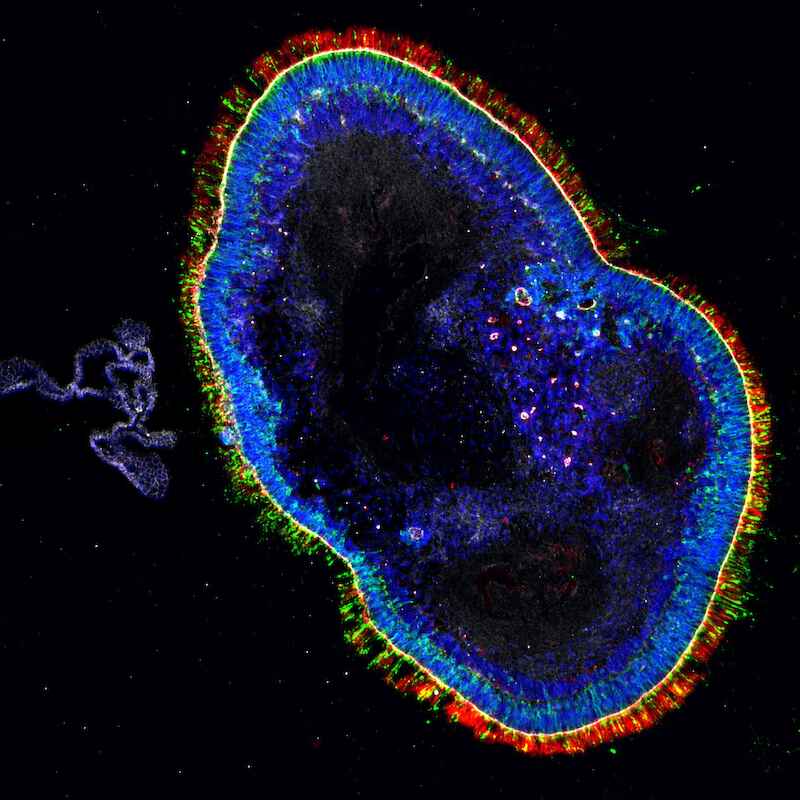 (1) Mini-Netzhaut aus der Petrischale: Das Roska-Team züchtet diese nur etwa zwei mal zwei Millimeter kleinen Retina-Organoide aus pluripotentenStammzellen. Die Photorezeptoren sind rot und grün markiert, die übrigen Zellen blau.