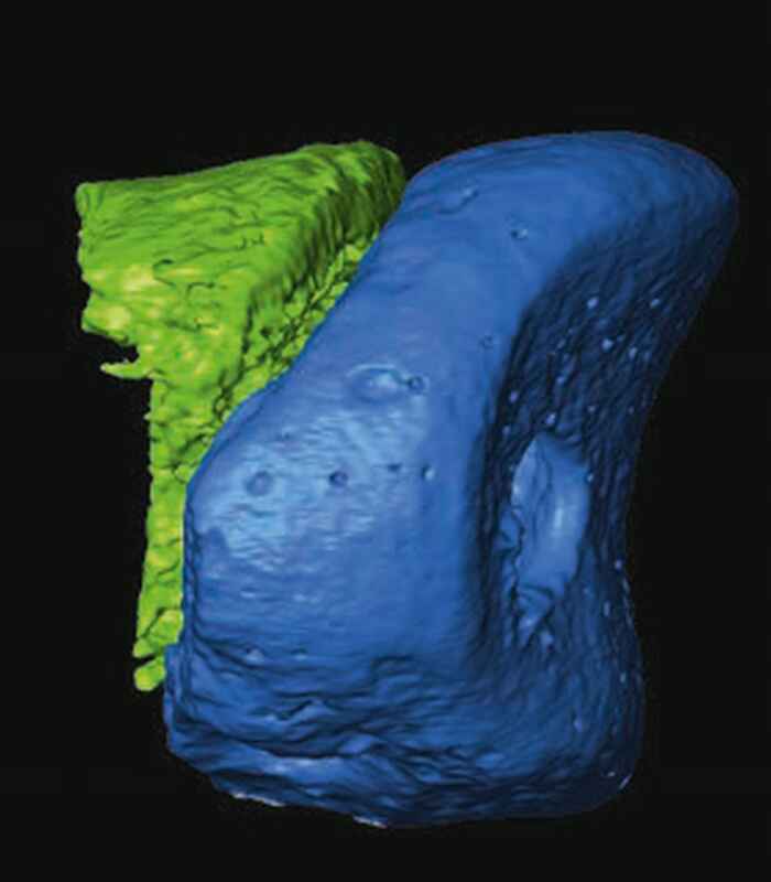 Computertomographie eines Fingerknochensegments aus der Denisova-Höhle. Dank fortgeschrittener Sequenziertechnik reichte diese kleine Probe, um 2012 das gesamte Genom des Denisova- Menschen zu entschlüsseln.